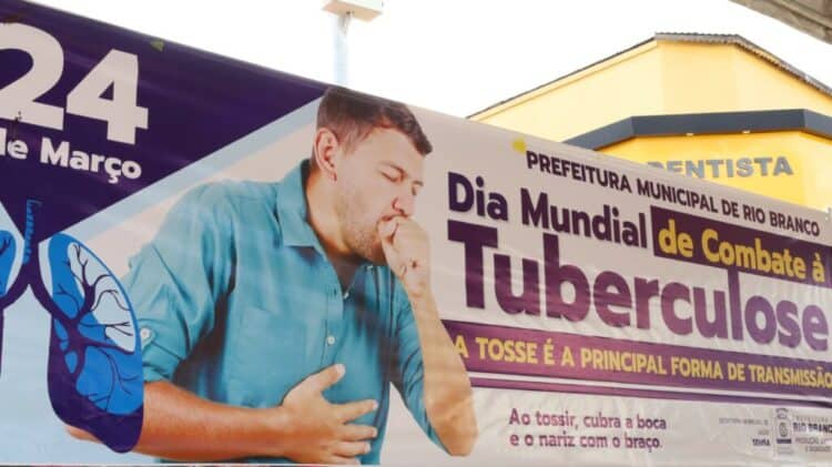 GdA e prefeituras unem esforços contra tuberculose
