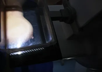 Mulheres de baixa renda terão exames gratuitos de câncer de mama