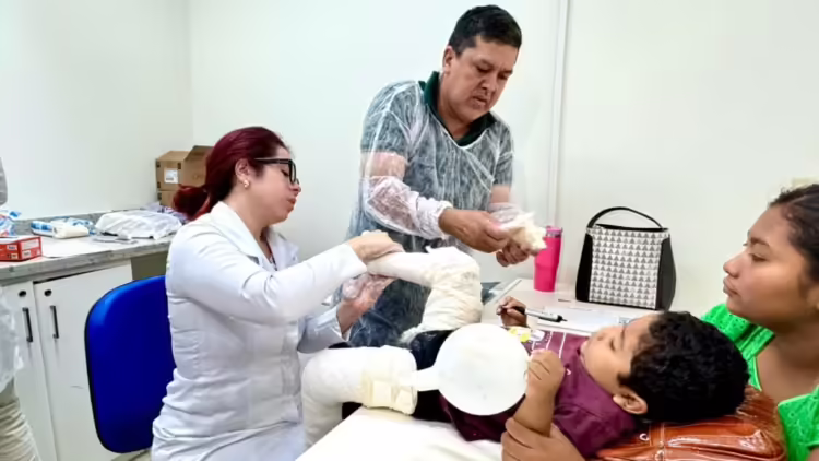 Ambulatório da Fundhacre trata 228 crianças com pé torto em 2024