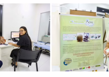 Ufac lança projeto-piloto de TeleECG e transforma acesso à saúde